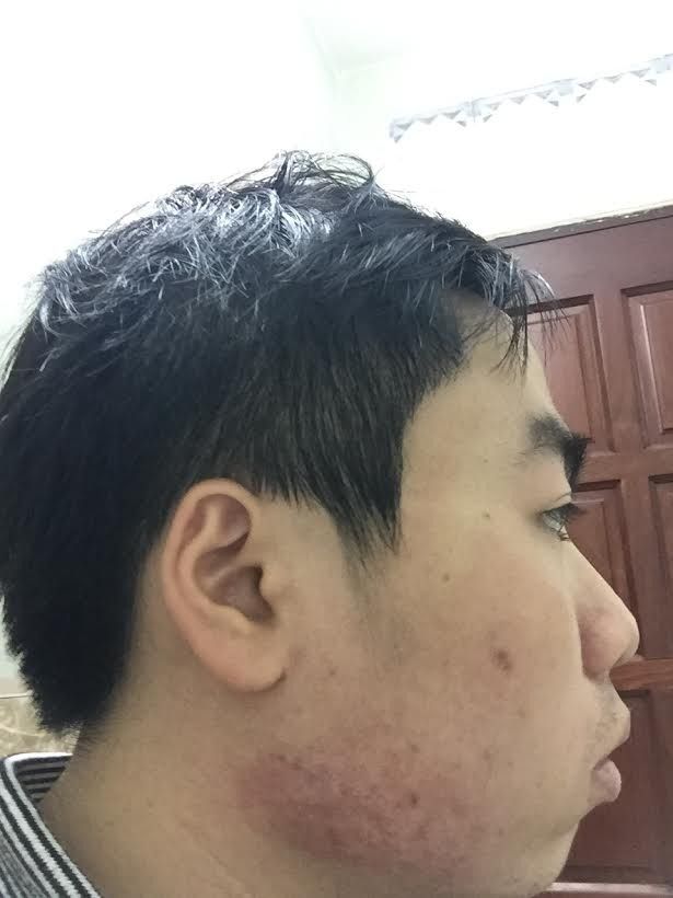 Hình ảnh